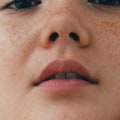 Cosmetics and Acne: A Comprehensive Overview