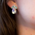 Exploring the Genetics Behind Acne