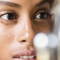 Prescription Medications for Adult Acne: A Comprehensive Overview