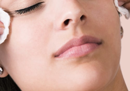 Chemical Peels for Acne Scars: Everything You Need to Know