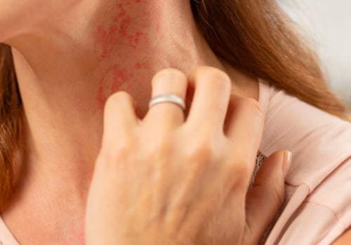 Avoiding Potential Irritants and Allergens