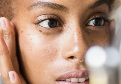 Prescription Medications for Adult Acne: A Comprehensive Overview