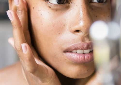 Topical Retinoids for Adult Acne: A Guide to Medical Treatments
