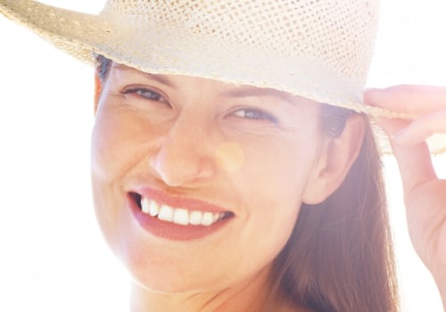 Limiting Sun Exposure for Acne Prevention